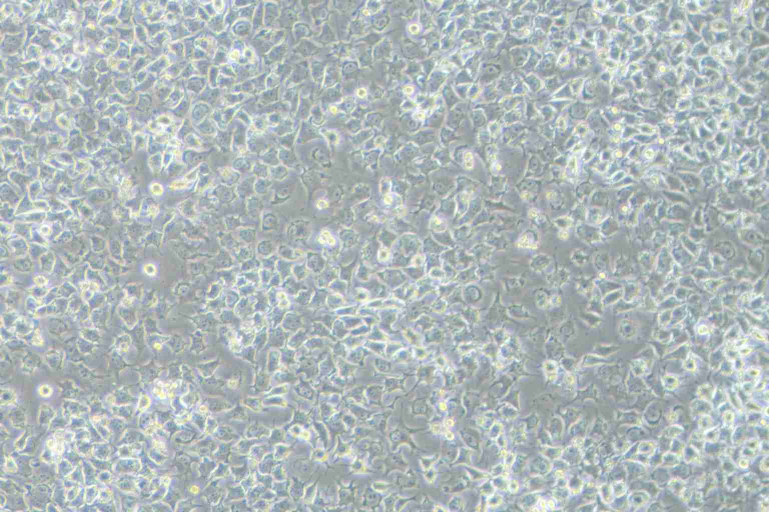 92-1 [Human uveal melanoma] Cell Complete Medium - 3