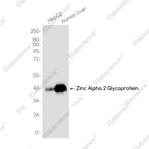 Recombinant Zinc Alpha 2 Glycoprotein Monoclonal Antibody - 1