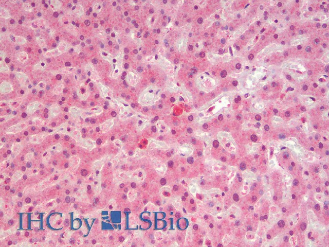 Immunohistochemistry analysis of paraffin-embedded Human Liver using c-Fos Polyclonal Antibody(Elabscience Product Detected by Lifespan).