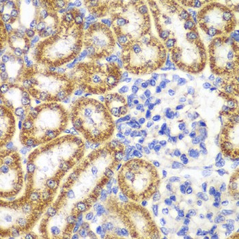 Immunohistochemistry of paraffin-embedded Rat kidney using UGDH Polyclonal Antibody at dilution of 1:100 (40x lens).