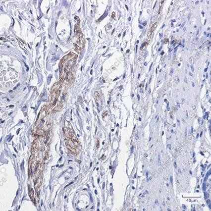 Recombinant Phospho-PKCα (Thr638) Monoclonal Antibody - 3