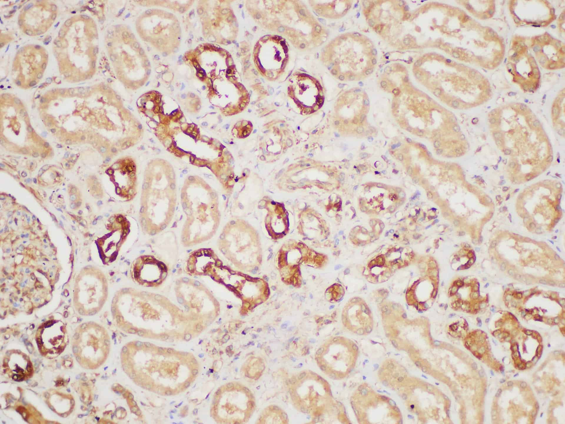 Immunohistochemistry of paraffin-embedded Human kidney using PAIP1 Polycloanl Antibody at dilution of 1:200.