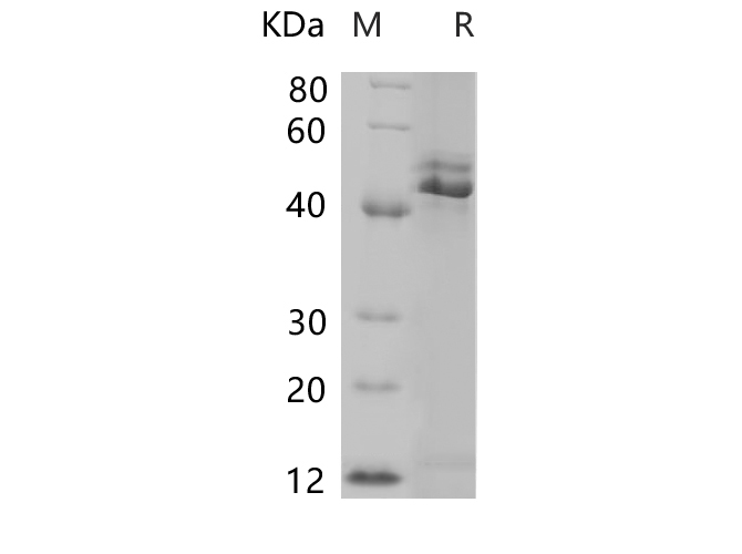 Recombinant Rat CD75/ST6GAL1 Protein (His Tag)-1