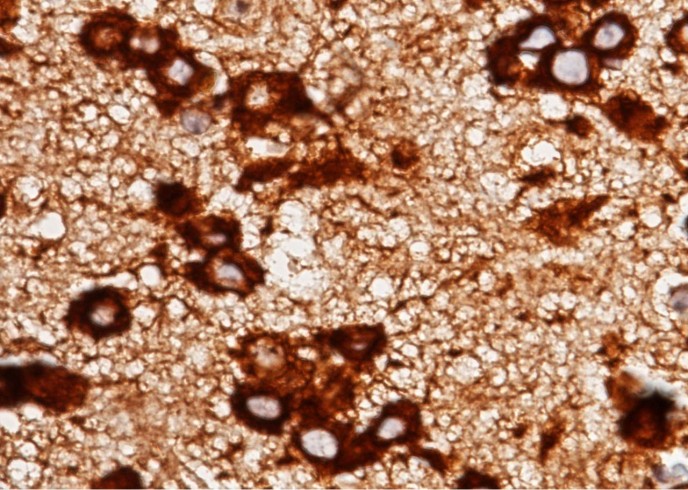 Recombinant LRPAP1 Monoclonal Antibody-searchlist-1