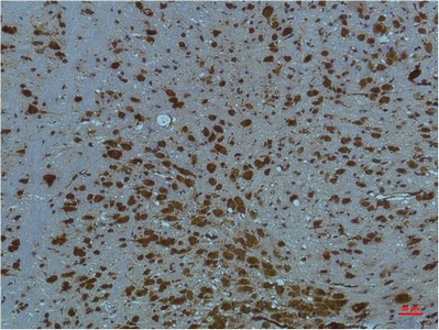 Immunohistochemistry of paraffin-embedded Mouse brain tissue using PI 3 kinase p85 alpha Monoclonal Antibody at dilution of 1:200.