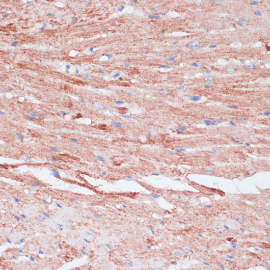 Immunohistochemistry of paraffin-embedded Mouse heart using VASP Polyclonal Antibody at dilution of  1:100 (40x lens).