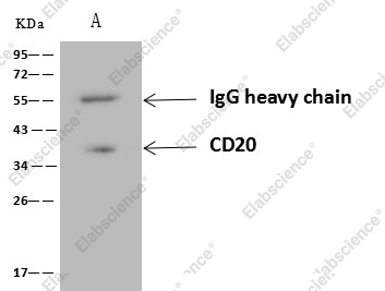 CD20/MS4A1 Monoclonal Antibody - 5