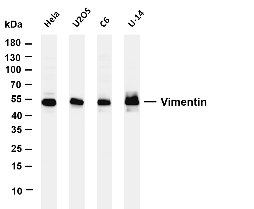 Recombinant Vimentin Monoclonal Antibody - 2