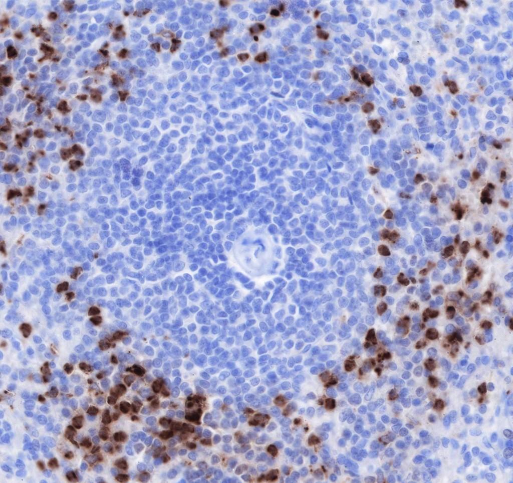 Recombinant CEACAM6 Monoclonal Antibody - small - 2