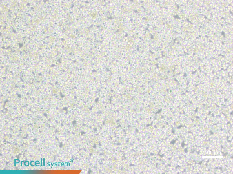 PC 61 5.3 [PC 61; PC 61.5.3] Cell Complete Medium - 1