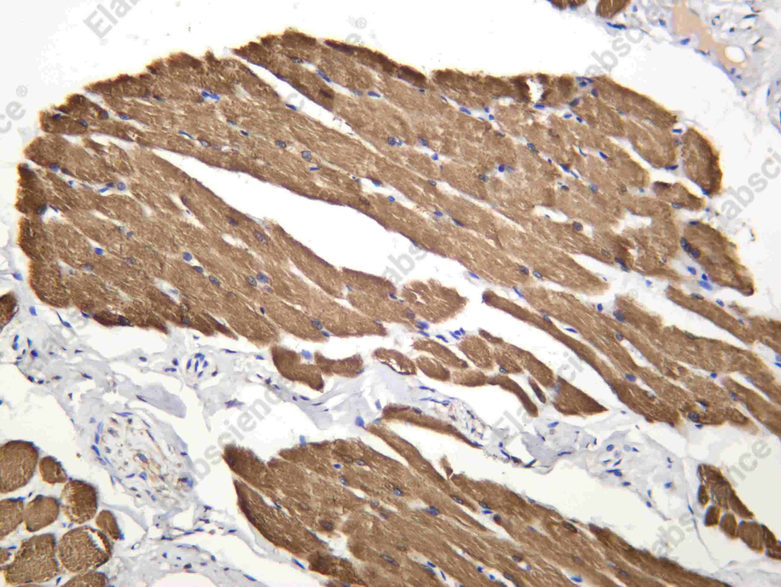 Recombinant Amphiphysin II Monoclonal Antibody - 1