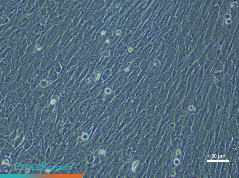 Human Ovarian Cancer Fibroblast (Primary cell immortalization) Complete Medium - 5
