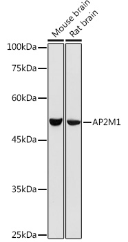 Western blot analysis of extracts of various cell lines using AP2M1 Polyclonal Antibody at 1:500 dilution.