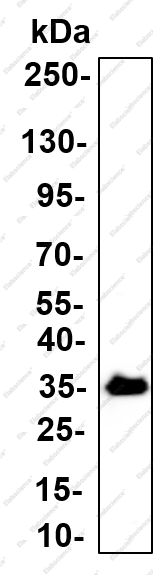 Recombinant PHX2B Monoclonal Antibody - 1