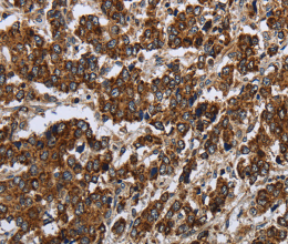 PPP1R13L Polyclonal Antibody - 3