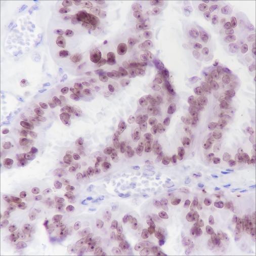 Recombinant Cleaved PARP1 p25 Monoclonal Antibody - 3