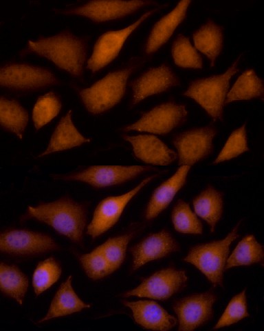 Immunofluorescence analysis of L929 cells using ECSIT Polyclonal antibody at dilution of 100 (40x lens). Blue: DAPI for nuclear staining.
