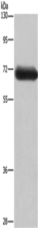 Western Blot analysis of Mouse brain tissue using DPYSL3 Polyclonal Antibody at dilution of 1:350