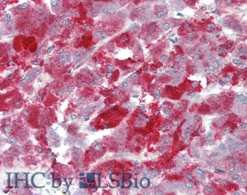 Immunohistochemistry of paraffin-embedded Human Adrenal using NRN1 Polyclonal Antibody at dilution of 1:70(Elabscience Product Detected by Lifespan).