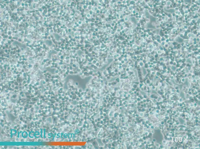 alpha TC1 clone 6 Cell Complete Mediumalpha TC1 clone 6 Cell Complete Medium - 3