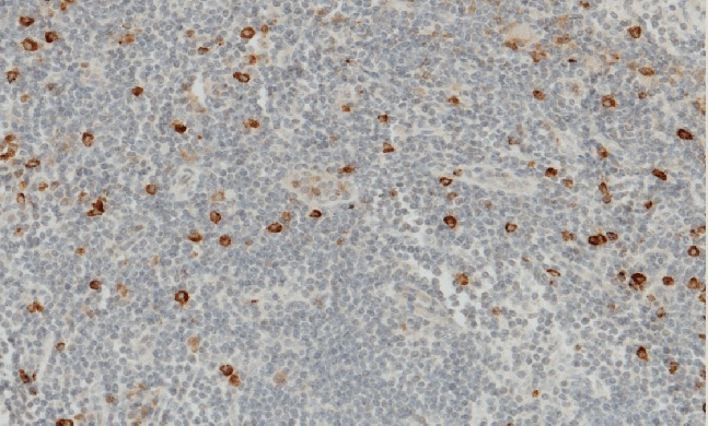Recombinant Granzyme B/GZMB Monoclonal Antibody - small - 3