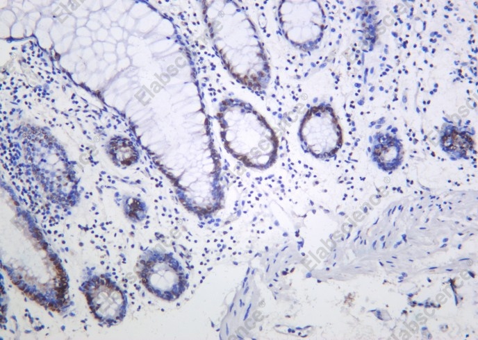 Recombinant Phospho-Rpb1 (Ser5) Monoclonal Antibody - 2