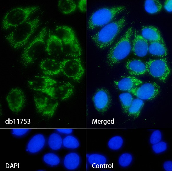 Recombinant IGFBP7 Monoclonal Antibody - small - 4