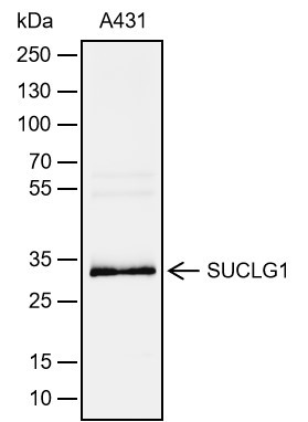 Recombinant SUCLG1 Monoclonal Antibody - 3