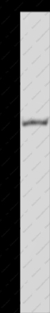 NEDD9 Polyclonal Antibody - 1