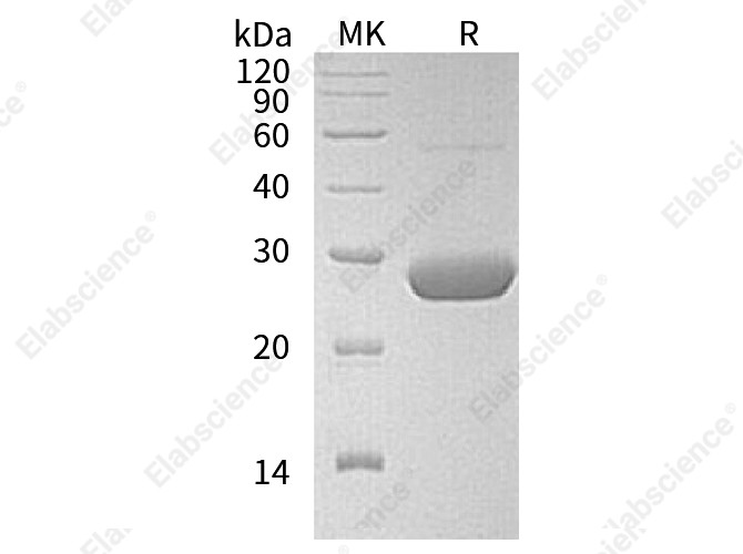 Recombinant Human LYPLA2 Protein (His Tag) - 1