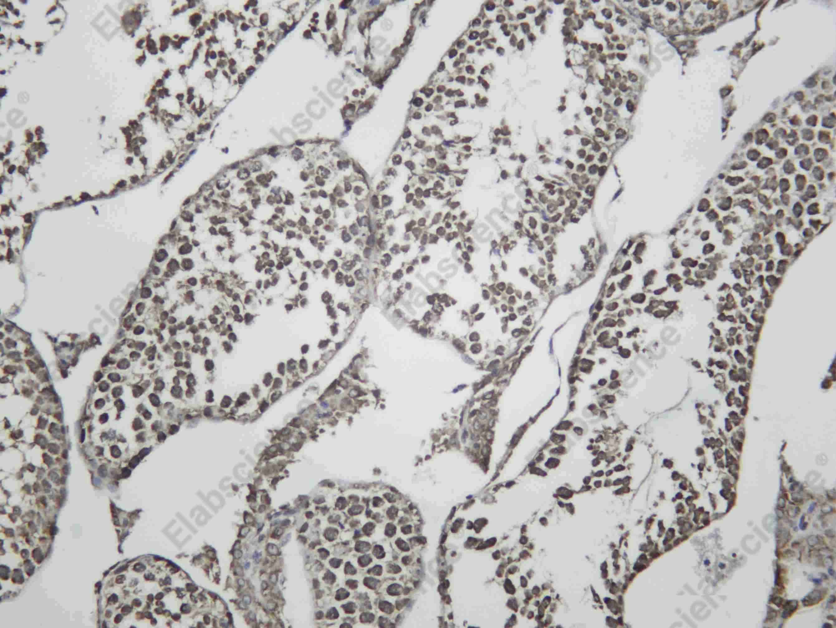 Recombinant Huntingtin Monoclonal Antibody - 3