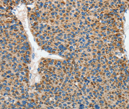 DSCR1 Polyclonal Antibody - 2