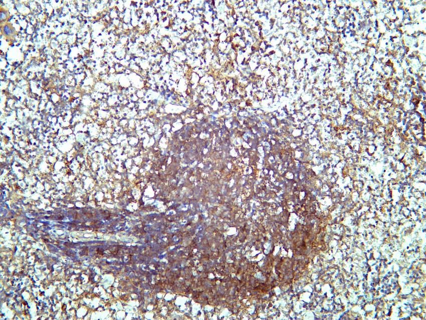 Recombinant SQSTM1/p62 Monoclonal Antibody - small - 4