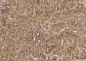 VEGF/VEGFA Monoclonal Antibody - small - 2
