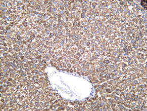 Recombinant MBL Monoclonal Antibody - 2