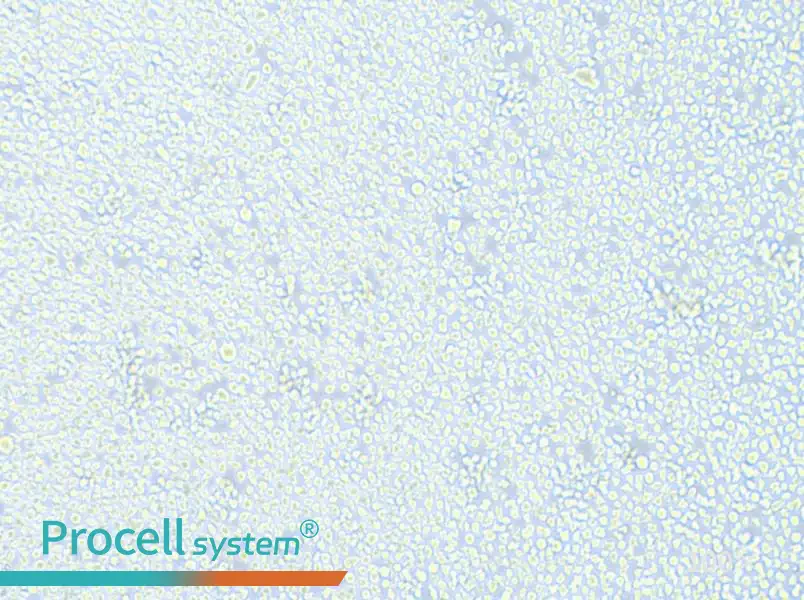 AMO1 Cell Complete Medium - 1