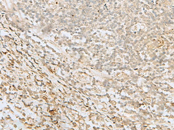 Immunohistochemistry of paraffin-embedded Human tonsil tissue  using LYRM1 Polyclonal Antibody at dilution of 1:50(?200)