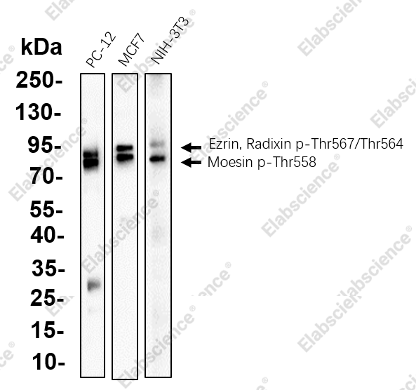 Recombinant Ezrin/Radixin/Moesin (Phospho Thr567/Thr564/Thr558) Monoclonal Antibody - 1