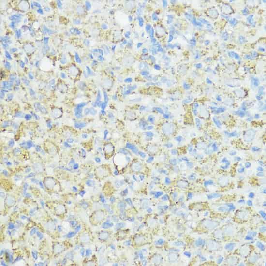 Immunohistochemistry of paraffin-embedded Rat ovary using SOD3 Polyclonal Antibody at dilution of 1:100 (40x lens).