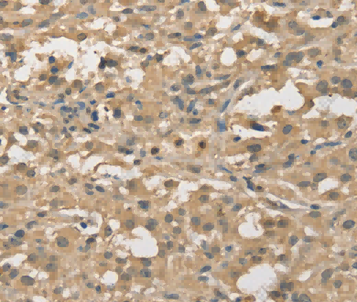 ALDH8A1 Polyclonal Antibody - 2