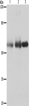 Western Blot analysis of Human cervical cancer, legs fibrous histiocytoma and fetal brain tissue using NECTIN1 Polyclonal Antibody at dilution of 1:400