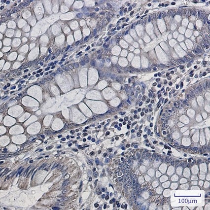 Recombinant UQCRFS1/RISP Monoclonal Antibody - 2