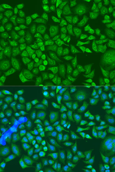 Immunofluorescence analysis of U2OS cells using IGF2BP2 Polyclonal Antibody at dilution of  1:100. Blue: DAPI for nuclear staining.