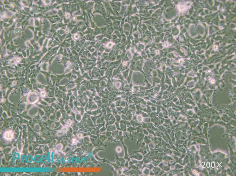 2V6.11 Cell Complete Medium - 6