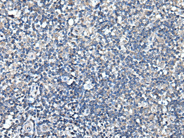 Immunohistochemistry of paraffin-embedded Human tonsil tissue  using TRIM23 Polyclonal Antibody at dilution of 1:55(?200)