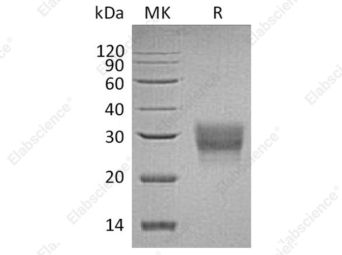 Recombinant Human CD8 beta/CD8B Protein (His Tag) - 1