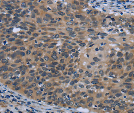 AVEN Polyclonal Antibody - 3
