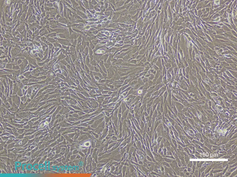 Mouse Pulmonary Great Artery Smooth Muscle Cell Complete Medium - 3