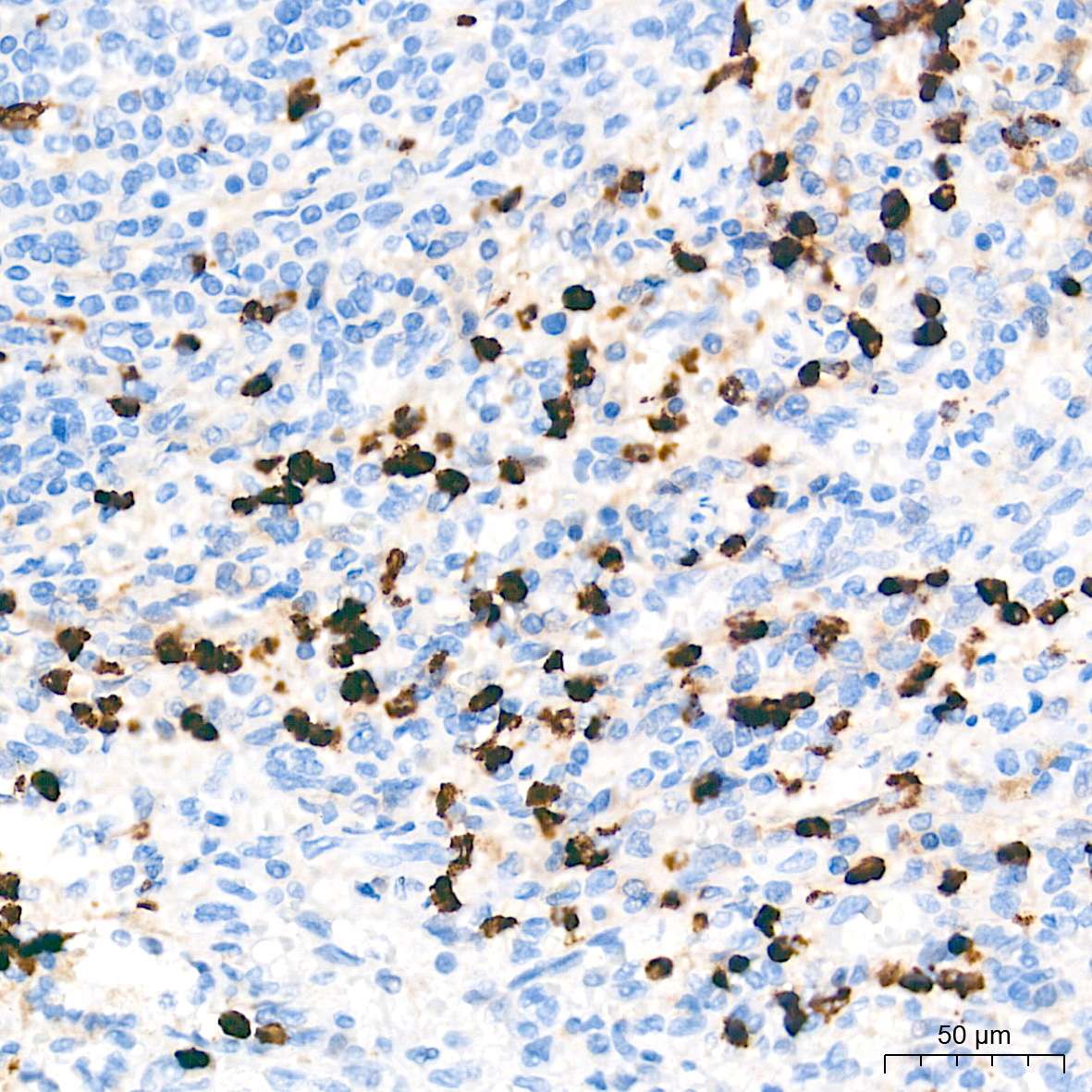 MMP9 Polyclonal Antibody - small - 5