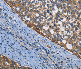 PGK1 Polyclonal Antibody - 2